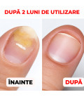 Soluție Intensivă pentru Unghii Fragile, Cuticule și Piele Active Care Solution StraDerm 30 ml