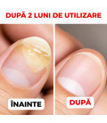 Soluție Intensivă pentru Unghii Fragile, Cuticule și Piele Active Care Solution StraDerm 30 ml